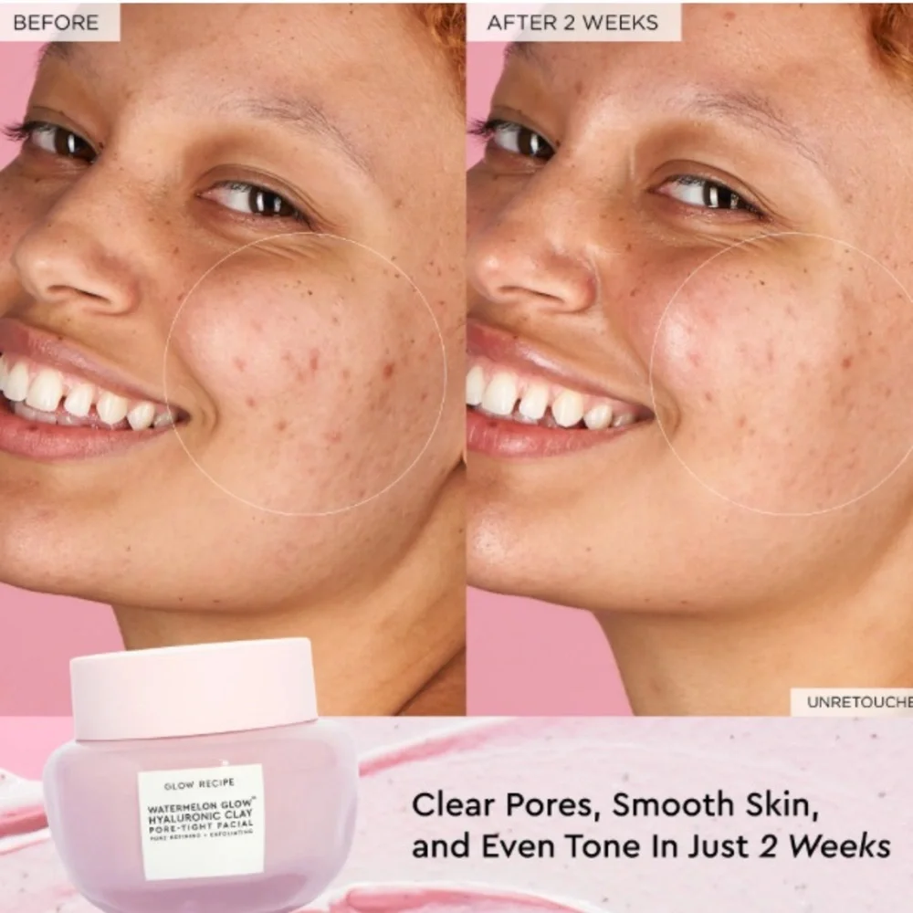 💎 Glow Recipe Watermelon Glow Hyaluronic Clay Pore-Tight Facial Mask Full-Size